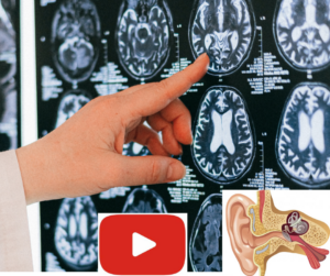 pointing to brain w ear-video